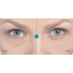 Remescar Borse & Occhiaie crema correttiva per il contorno occhi 8 ml Remescar Borse & Occhiaie crema correttiva per il contorno occhi 8 ml