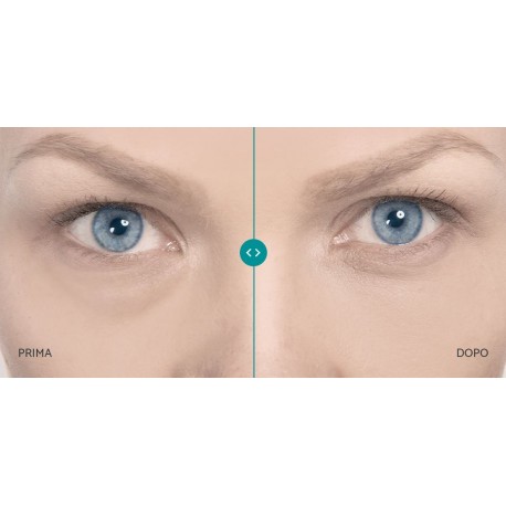 Remescar Borse & Occhiaie crema correttiva per il contorno occhi 8 ml Remescar Borse & Occhiaie crema correttiva per il contorno occhi 8 ml