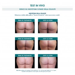 Miamo Body Renew Cellulite Multi-Action Emulgel -Trattamento anticellulite 200 ml