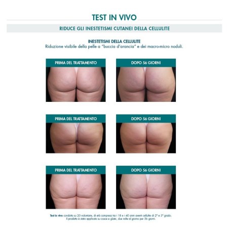 Miamo Body Renew Cellulite Multi-Action Emulgel -Trattamento anticellulite 200 ml