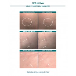 Miamo Body Renew Stretch Marks Multi-Action Cream Crema anti smagliature 150 ml