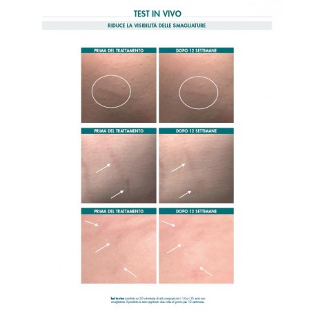 Miamo Body Renew Stretch Marks Multi-Action Cream Crema anti smagliature 150 ml