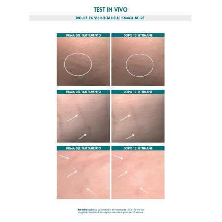 Miamo Body Renew Stretch Marks Multi-Action Cream Crema anti smagliature 150 ml