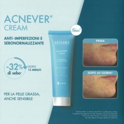 Miamo Acnever Cream crema viso anti-imperfezioni sebonormalizzante 50 ml