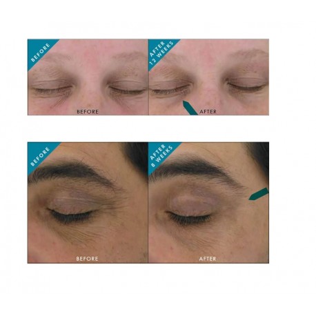 SkinCeuticals Aox+ Eye Gel contorno occhi antiossidante per borse e occhiaie 15 ml SkinCeuticals Aox+ Eye Gel contorno occhi antiossidante per borse e occhiaie 15 ml