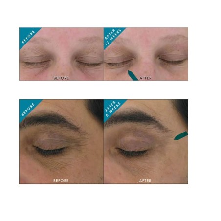 SkinCeuticals Aox+ Eye Gel contorno occhi antiossidante per borse e occhiaie 15 ml SkinCeuticals Aox+ Eye Gel contorno occhi antiossidante per borse e occhiaie 15 ml