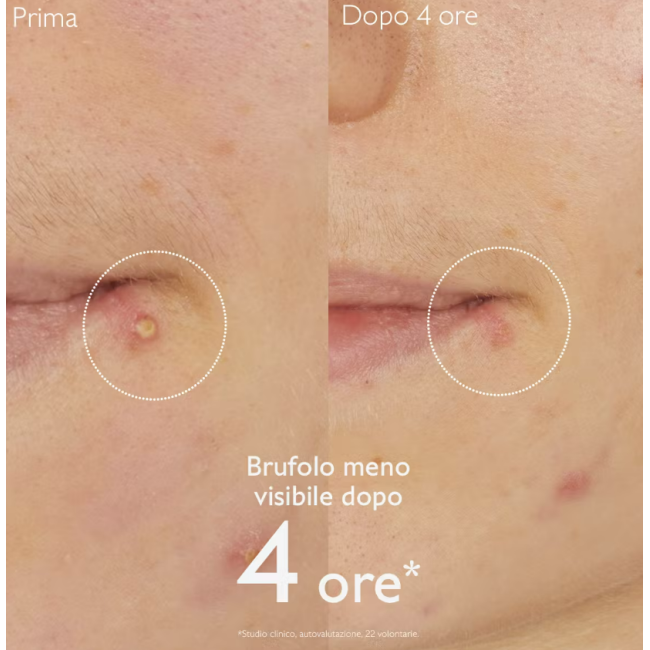 Caudalie Vinopure Soluzione salicilica Stop Brufoli 15 ml Caudalie Vinopure Soluzione salicilica Stop Brufoli 15 ml