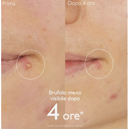 Caudalie Vinopure Soluzione salicilica Stop Brufoli 15 ml Caudalie Vinopure Soluzione salicilica Stop Brufoli 15 ml