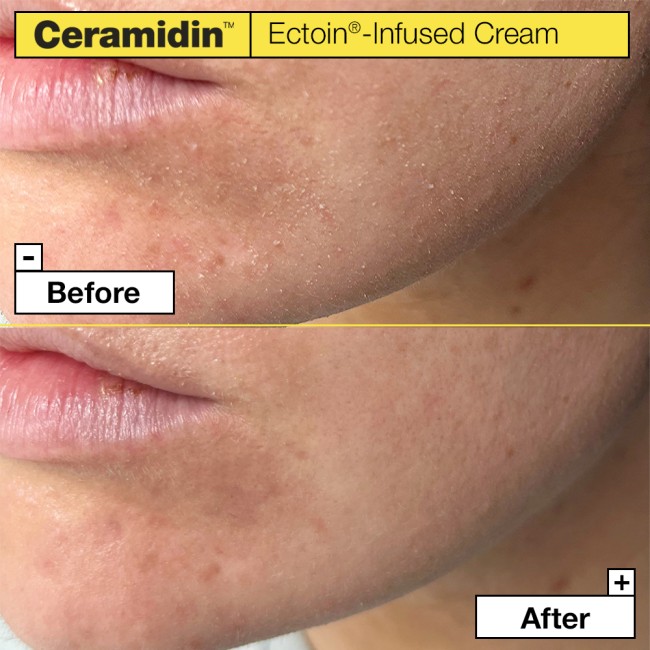 Dr. Jart+ Ceramidin Ectoin-Infused Cream crema viso ultra-ricca 50 ml Dr. Jart+ Ceramidin Ectoin-Infused Cream crema viso ultra-ricca 50 ml