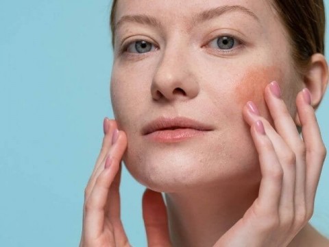 Creme per Dermatiti, Couperose, Arrossamenti e Cheratosi