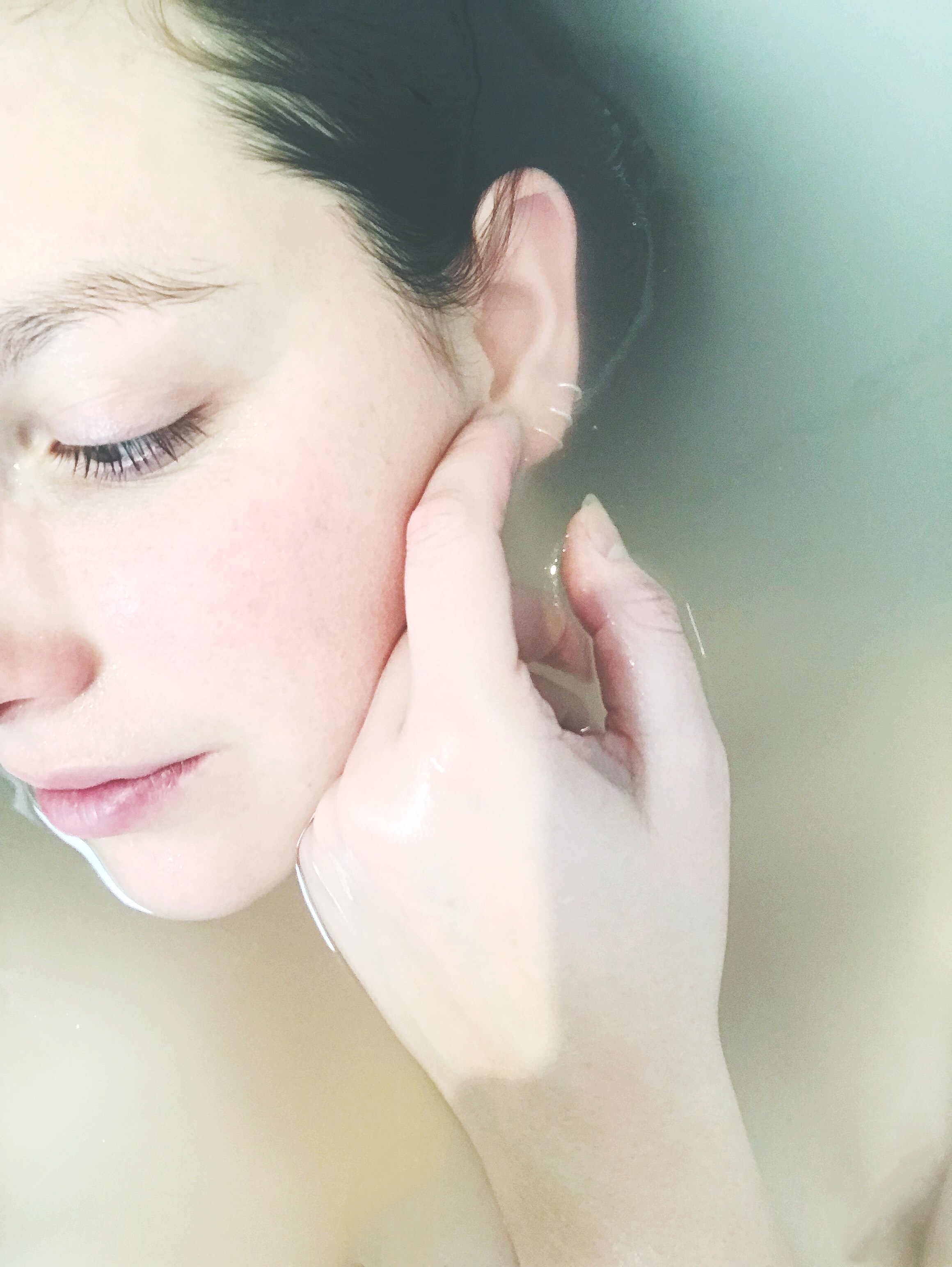 Acne tardiva: le cause e i migliori rimedi per sconfiggerla
