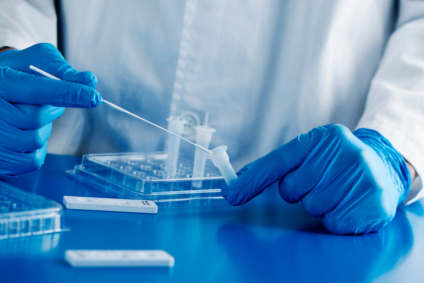 Tamponi e test sierologici per il Covid: facciamo chiarezza