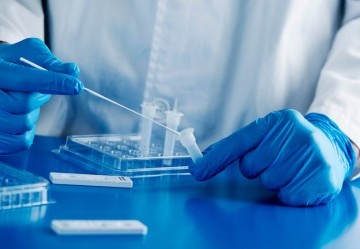 Tamponi e test sierologici per il Covid: facciamo chiarezza