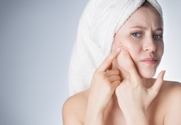 Acne o brufoli: come capire la differenza